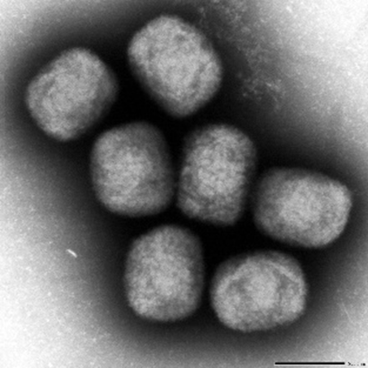 サル痘ウイルスの電子顕微鏡写真（国立感染症研究所より）